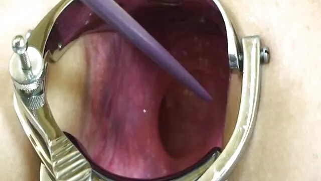 Mia Ryder là một châu Á, da đen, xxx nhật bản hay tàn bạo, shit trong sọ của cô ấy.